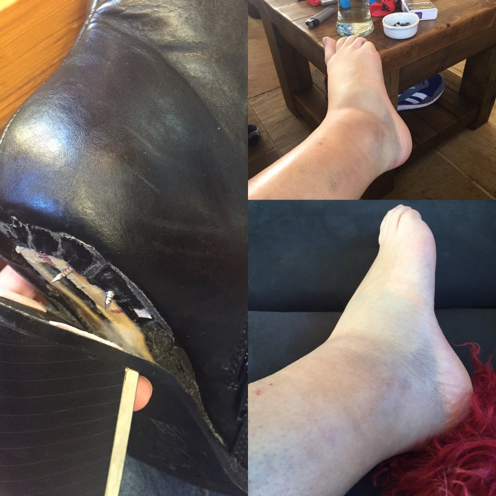 tottyberry's tweet photo. @ASOS @ASOS_HeretoHelp look what happened to my foot with a brand new pair of boots from #asos #sprainedankle 😔 https://t.co/cQB5jqkZZ4
