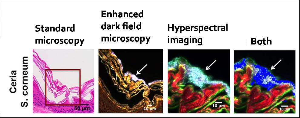 sbunewsdesk's tweet photo. New Method to Identify Nanoparticles in Tissue May Shed Light on Health Impact https://t.co/2qF0t4gitR #Science https://t.co/5u1Nc7o8ZT