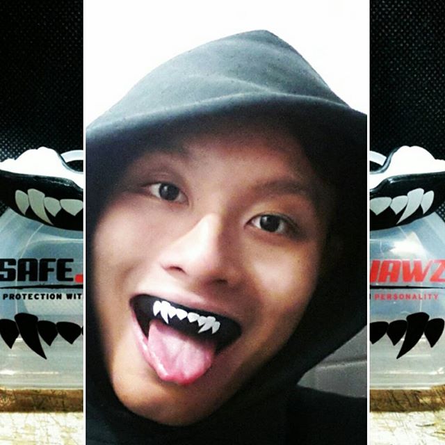 MouthguardShop's tweet photo. #safejawzselfie https://t.co/ccYImNpd0S