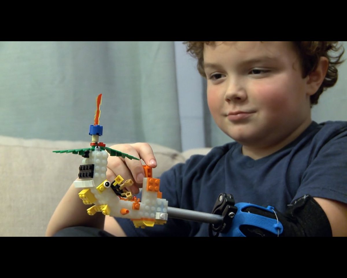 enableholidays's tweet photo. Children design new "superhero" prosthetic limbs!
https://t.co/TBDFA1mYTP @AmputeeNews @mcramputee @amputeerehab https://t.co/aFWkJIvimG