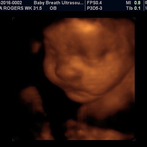 3d Baby Ultrasound breath1 Twitter