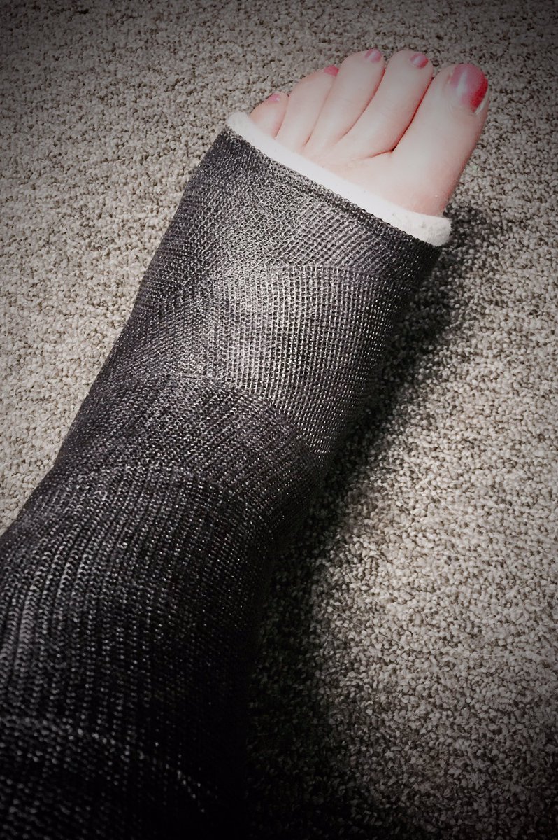 linda4news's tweet photo. These Little Piggies get a new wrap Wed. 4 more weeks to go. Ideas for the color of the new cast?You pick it. @kfor https://t.co/ZZCz25lRZp