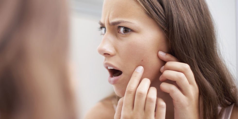 evolveskinreju's tweet image. Have a zit that just won't go away? #skintips ow.ly/ZZEpT