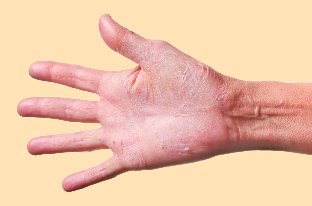 significato del dolore pelvico nel tagalog