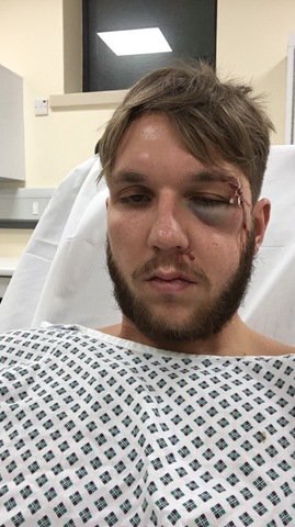 Goole AFC start Crowdfunder appeal for keeper Jack Wheat following horrific facial injuries bit.ly/1ZKfMNb