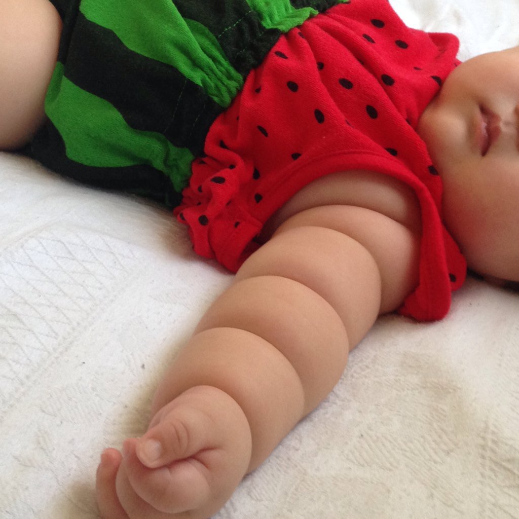 Tangan Bayi Bayi Ini Menggemaskan Seperti Roti Gulung Health Liputan6 Com