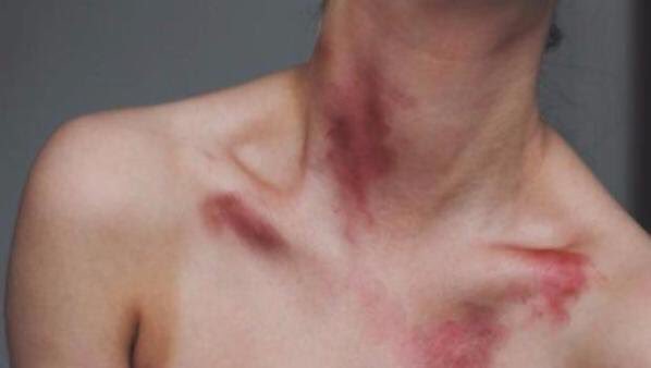 alex__alegria's tweet photo. If we date this is you. I'm sorry I'm a vampire and have no self control 😭😞 https://t.co/OCuaLSl7yn