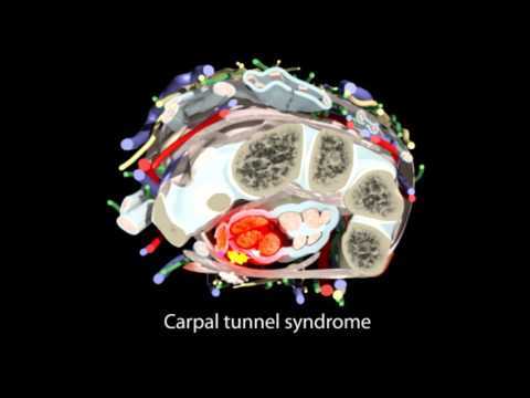 Dr Peter Isaacs tweet media