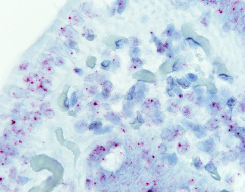 Descubren en el ADN ‘basura’ un gen clave en el desarrollo de la enfermedad celiaca buff.ly/1NeOZBg