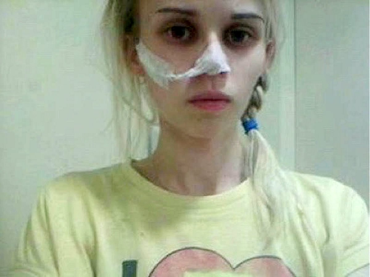BartonLyn's tweet photo. Family plea to help anorexic who believes seeing pics of food will pile on the pounds https://t.co/6SqBURSPzE https://t.co/K2peOUHNsy