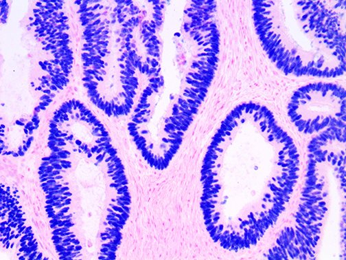 Bio_SB's tweet photo. Great pic! Combining our new rabbit monoclonal #antibody SATB2 & HRP Blue #chromogen https://t.co/jzqYWAMS6s https://t.co/YElHZkZKAA