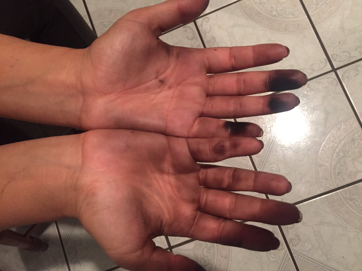 beyondalee's tweet photo. This is what 3A/3n+ and shitty gloves does to you :( I look like a jiffy lube employee lol #cosmoproblems https://t.co/9XYBR8YXsU