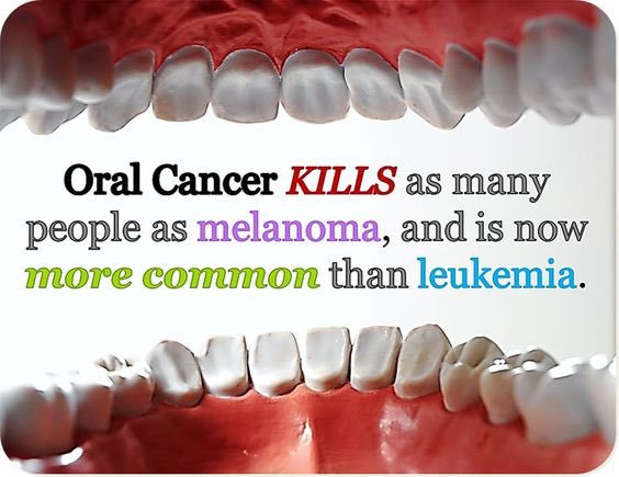 Oral cancer kills as many people as melanoma, as is now more common than leukemia. Oral Cancer Screening is vital.
