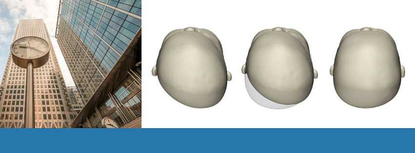 Cranioform's tweet image. Concerned about your baby's #headshape #plagiocephaly?Get advice in #Clinics #UK #DE #AT #CH goo.gl/T18gNb