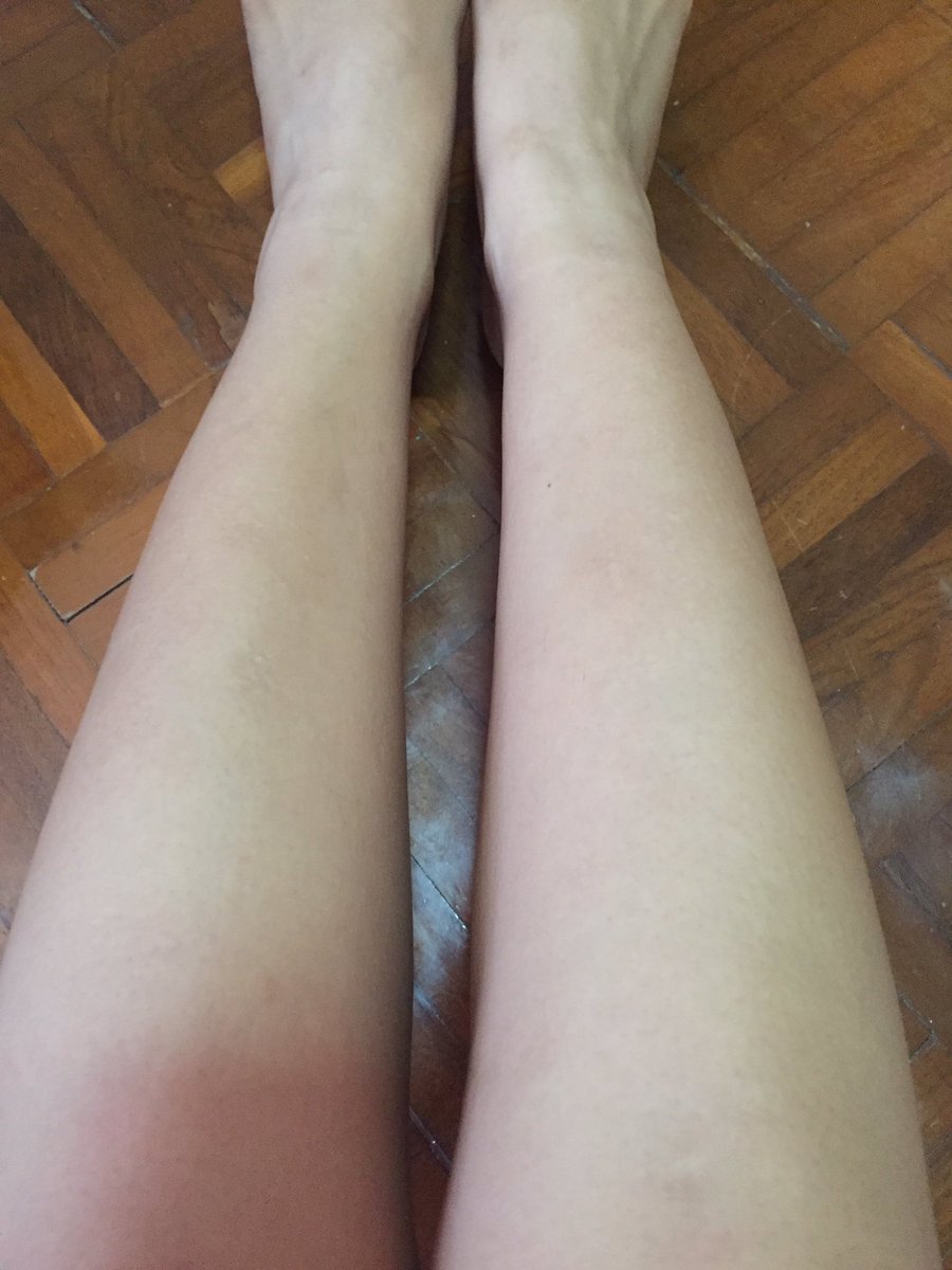AMR_AMRI01's tweet photo. เห้ยคือดี ชะนีมีขนต้องลอง!5-10นาทีขนเกลี้ยง บู้ทมีโปรยุ่ เหลือไม่ถึง200 ขนาดใหญ่เว่อออ #HowtoPerfect #ชี้เป้าโปรถูก https://t.co/mMGZQtmH7T