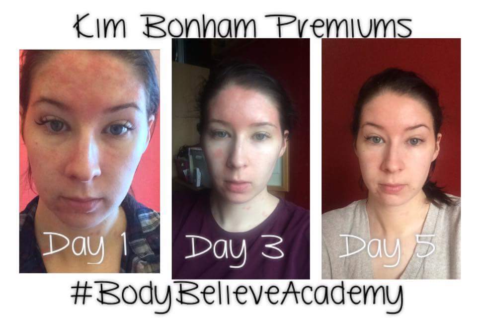 koisam's tweet photo. Great skin care 👌 more info link 👇👇👇
https://t.co/ycRPSaVQfX
#skincare #spots #pimples #redness #complection https://t.co/iJsMSH9XBq