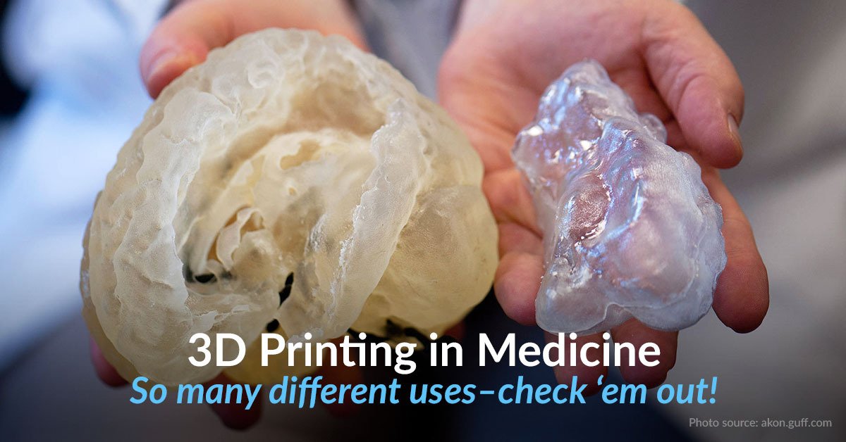 pinshape's tweet photo. 4 Applications of 3D Printing in the Medical Industry https://t.co/7f4QZkSAsZ #3dprinting #3dorgans https://t.co/caaeQWbQ7N