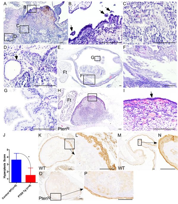 Oncotarget's tweet photo. https://t.co/9KzepEKJOL Featured cover paper in #Oncotarget https://t.co/KbOf1mbh9S - #ovarian #aging #Gerotarget https://t.co/g5oxIChe44