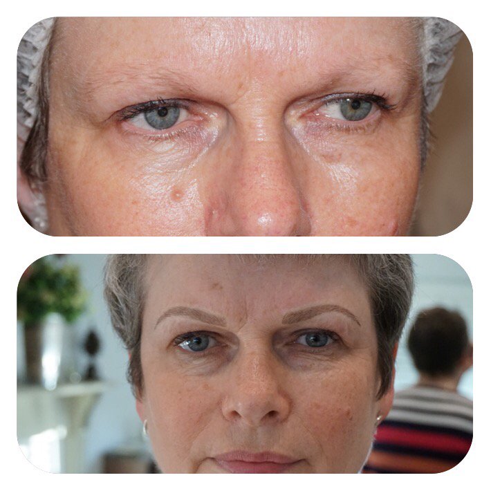 dollyfacemakeup's tweet photo. Before &amp;a after brows #semipermanentmakeup https://t.co/rgYML6UuoV