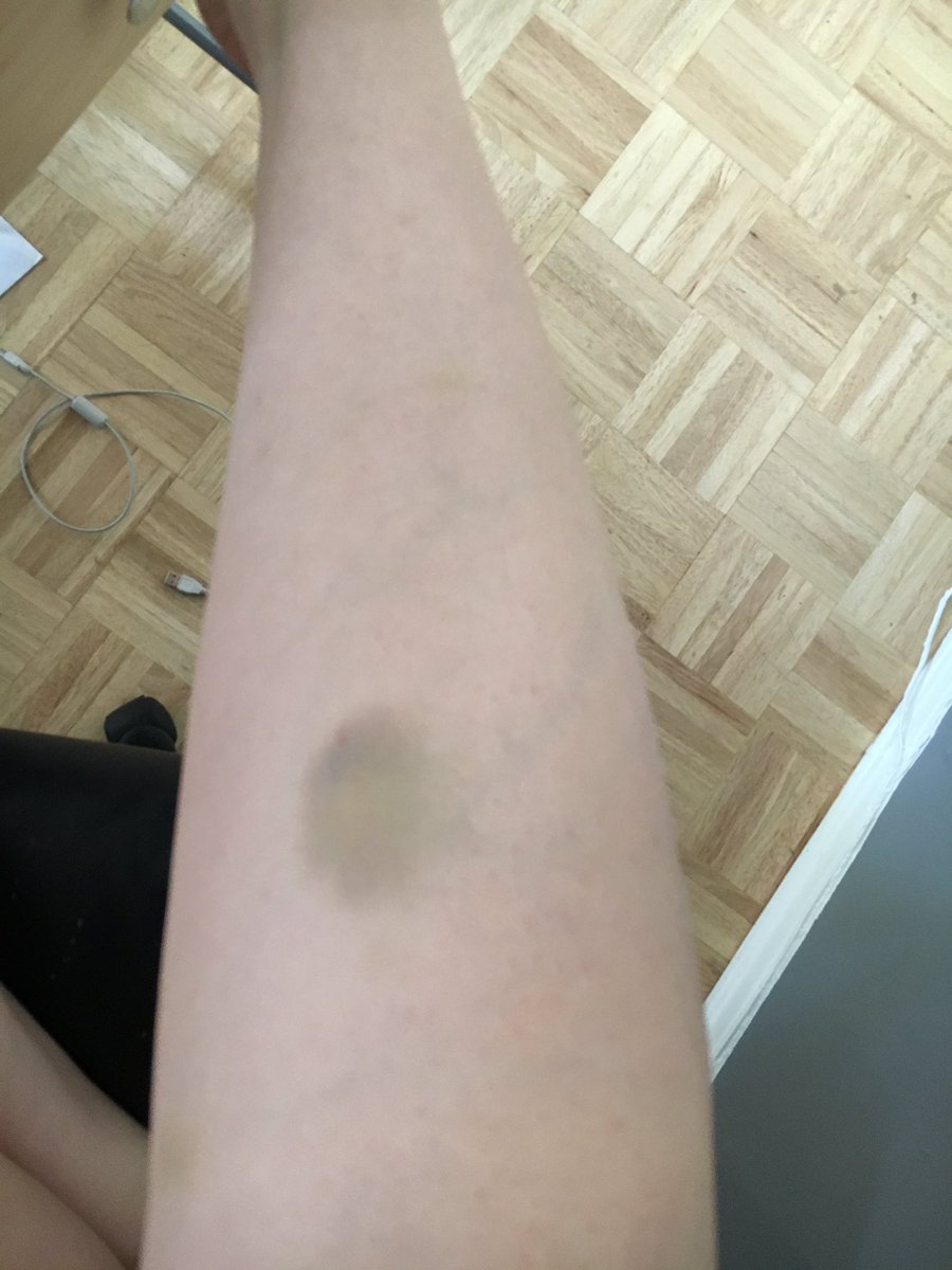 KaitlinWitcher's tweet image. Why me 💀