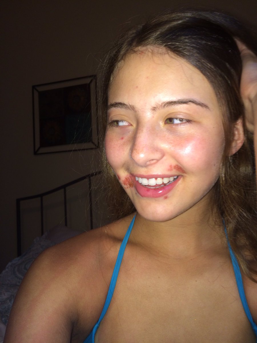 emelenii's tweet photo. pray for my friend @chloe_mckerr ain't nothin wrong w her she's just rlly ugly https://t.co/5kWgUAKJJT