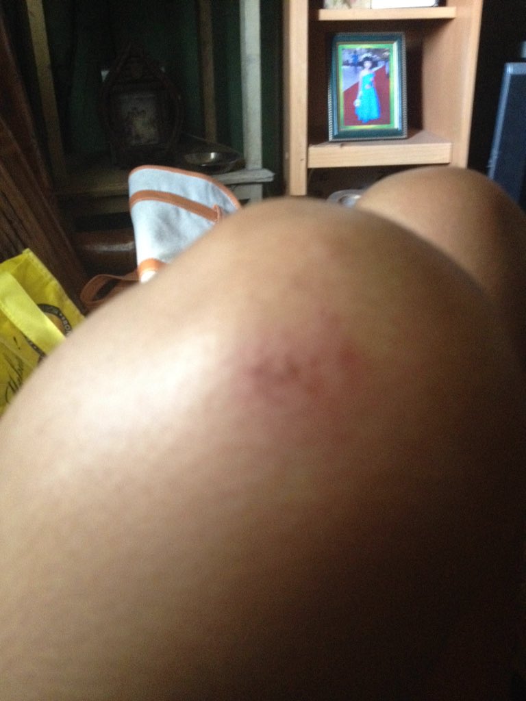 CAMSATAL's tweet photo. Sugat, ang dapat iniiyakan. Ngayon lang ulit nagasgasan. #frisbeeProblems https://t.co/9ttrSH6YSj