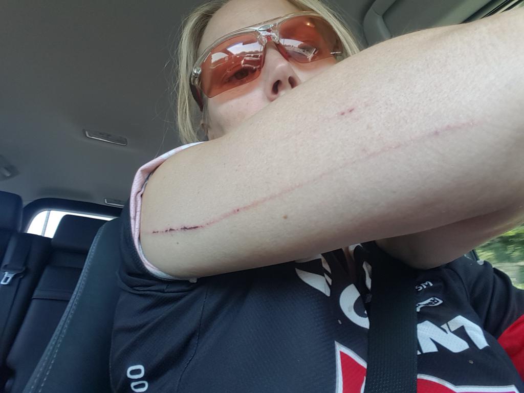 Helenpembie's tweet photo. Start an extreme sport at 40 they said.....it will be fun they said .....#restof damagex-rated https://t.co/rr59vBd29D