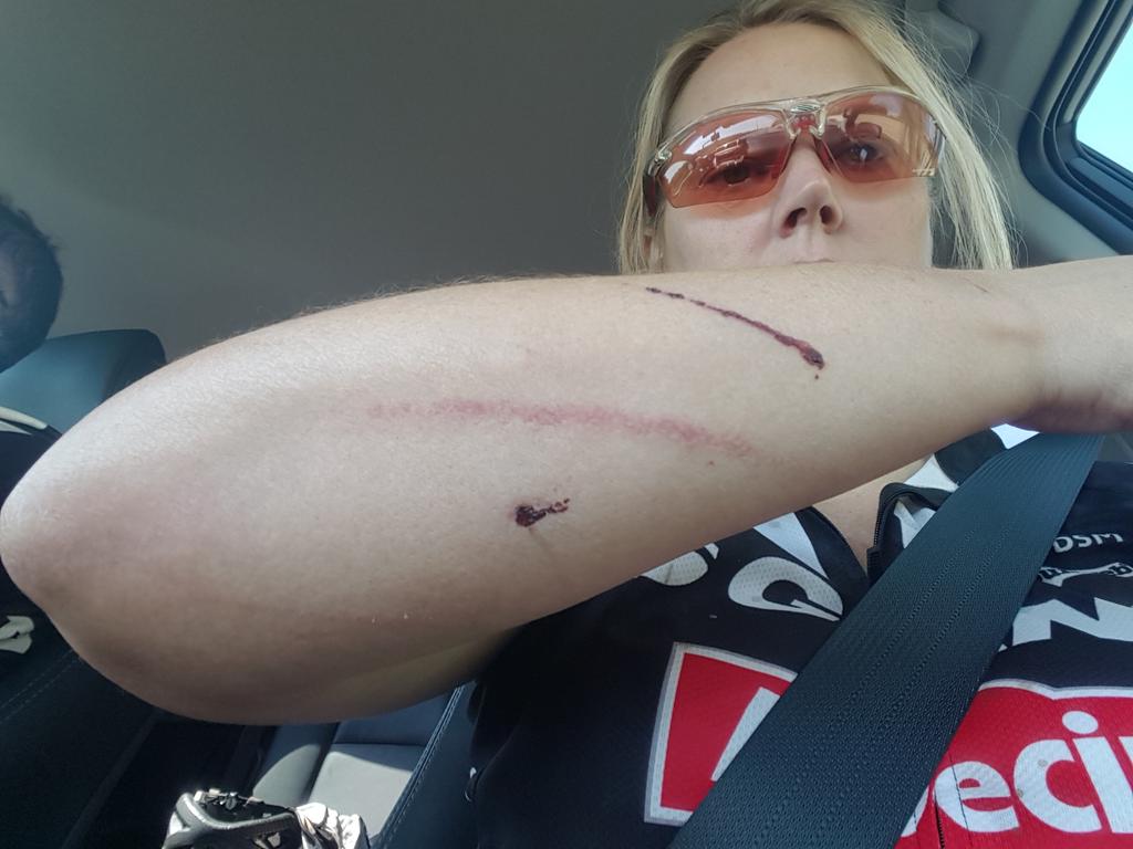Helenpembie's tweet photo. Start an extreme sport at 40 they said.....it will be fun they said .....#restof damagex-rated https://t.co/rr59vBd29D