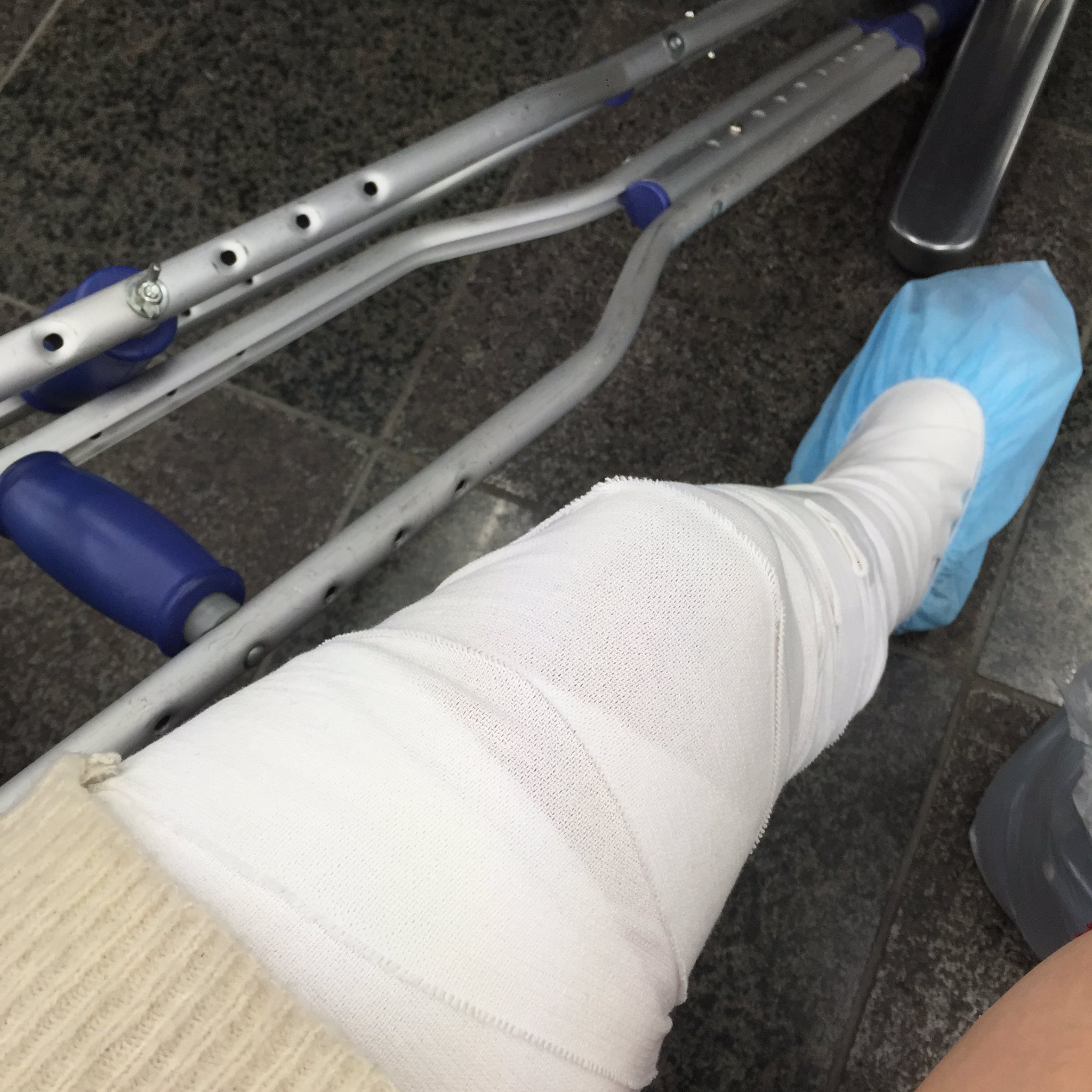 危険を察知したのに踊りを続行した事には大反省…でも足引きずってる状態なのに接客＋更にショーを平気で要求された事には正直傷ついた…断る事、中断する勇気をもたなかった結果他の現場様にも多大な迷惑をかけることになった事に大変反省しています https://t.co/JuGzghupFi