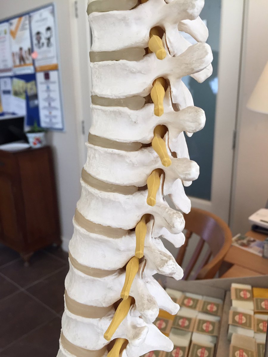 ZoeClarkOsteo's tweet photo. Plenty of info on #Osteopathy and although it's #notjustbacks we treat, of course we have our spine model out! 😏 https://t.co/RKV0SqhM75