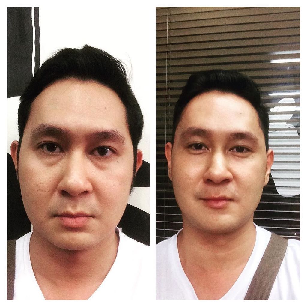 endronv's tweet image. #bestoftheday #photocollage #GPInstaFrame Made by @gpphotocollage Before &amp;amp; after #haircut … ift.tt/1TqpfbQ