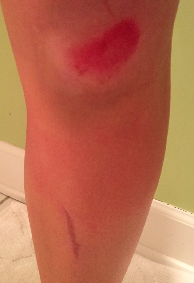 KateSullivan98's tweet photo. Don't know what's gonna kill me first: junior year or the concrete stairs and turf https://t.co/N2Gqa4zdYq