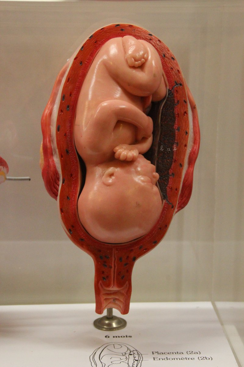 Le foetus au 6ème mois de grossesse 