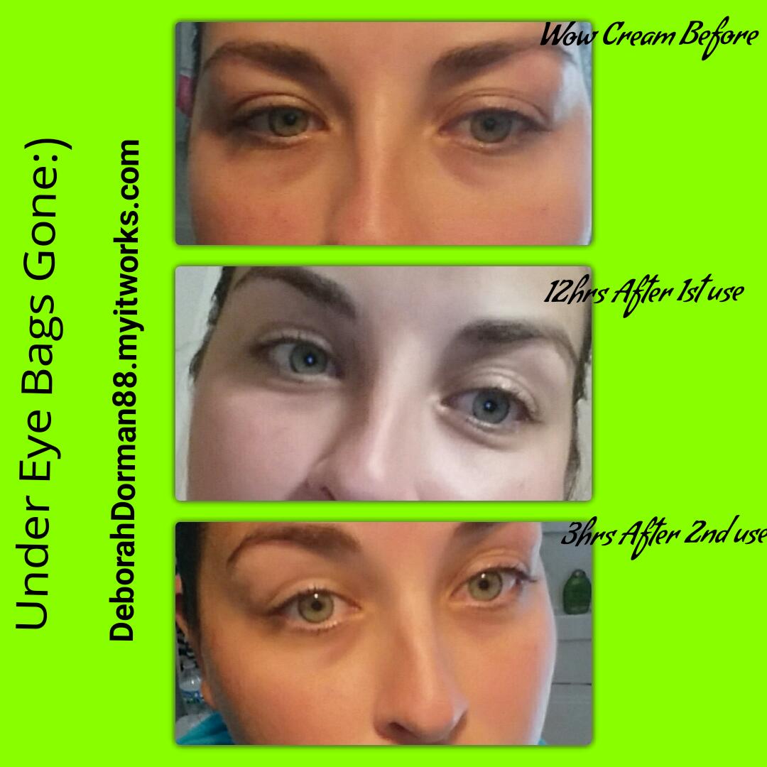 deborahdorman5's tweet photo. Goodbye under eye bags๐ message me today to get yours at my price! #itworks #WowCream https://t.co/ck1rkquCkz