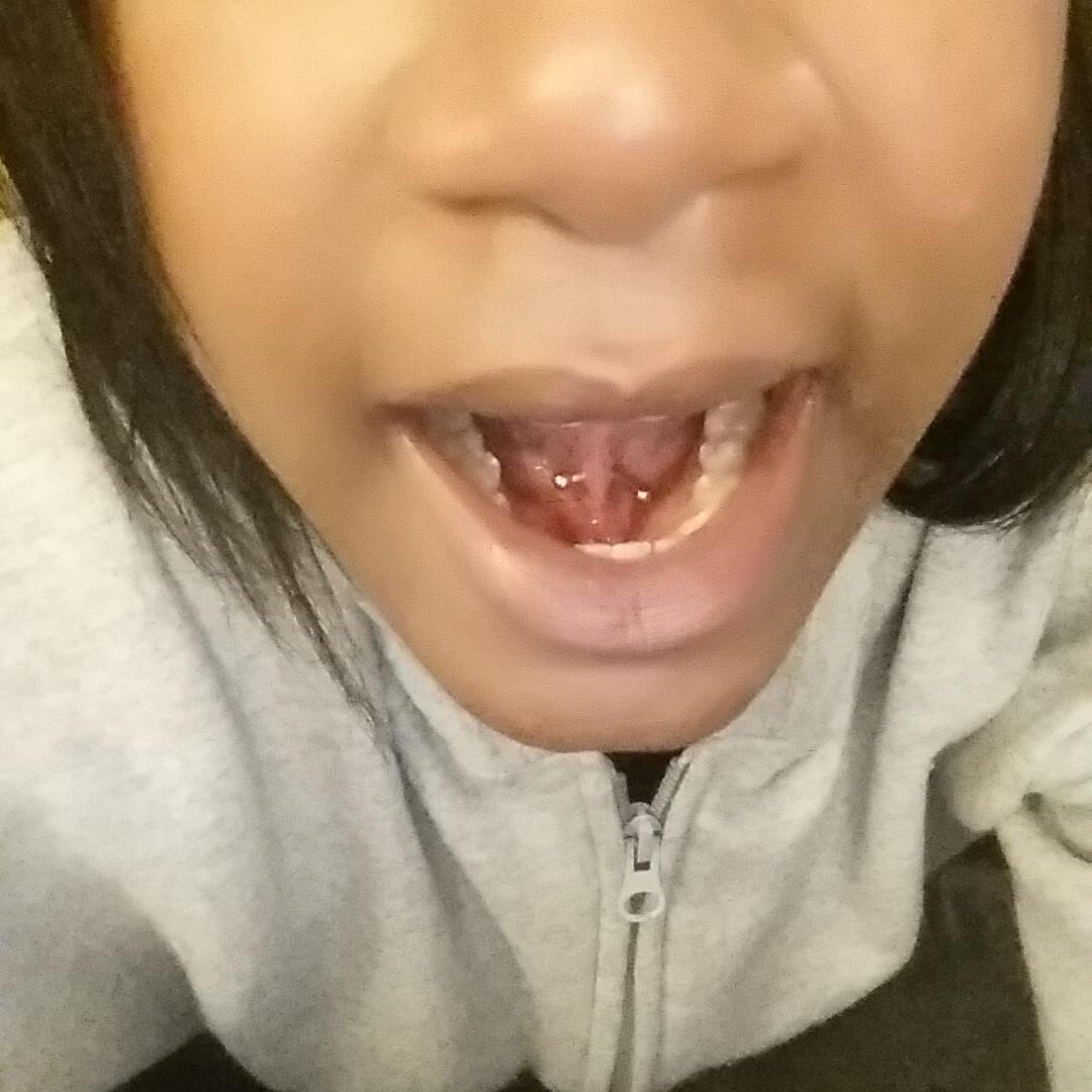 crownme_cute's tweet photo. Finally got the piercing I wanted for so long!!! #BobMarley #piercing #webpiercing ๐ ๐ ๐ https://t.co/qgpAzQqs75