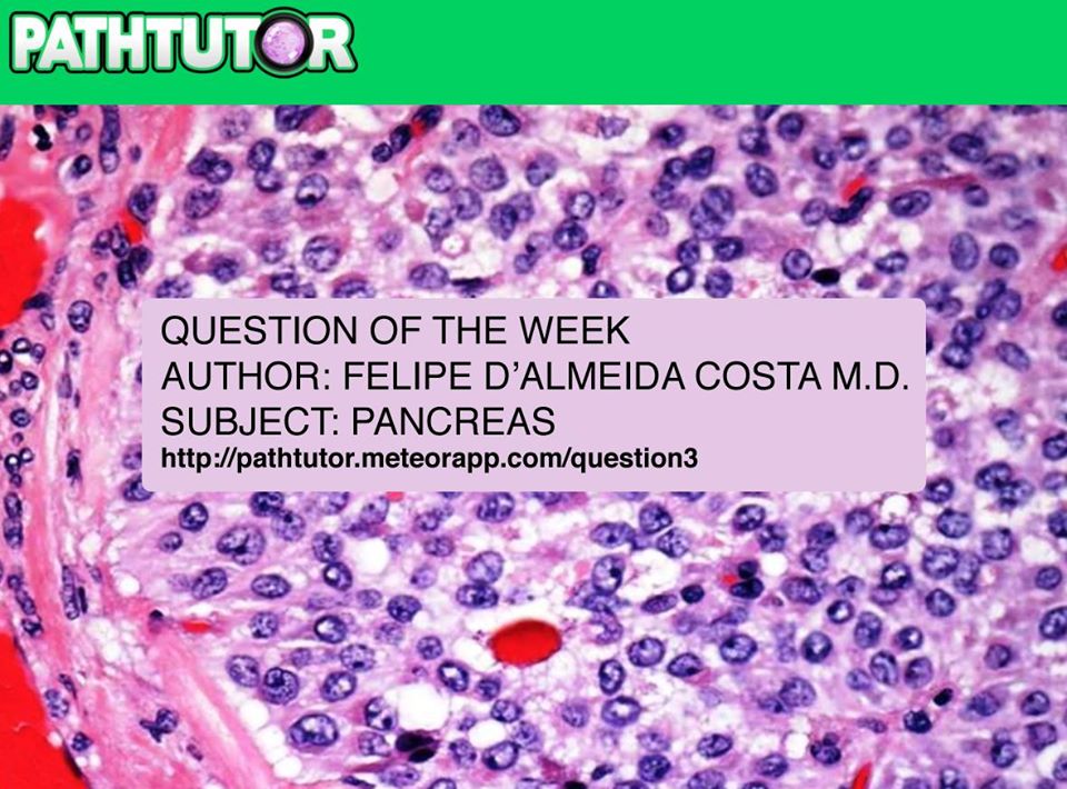 pathtutor_com's tweet image. pathtutor.meteorapp.com/question3 Pancreas - New feature choose IHC @JMGardnerMD @mreyesm @pbaleixo @luishcruzc @chioseasi