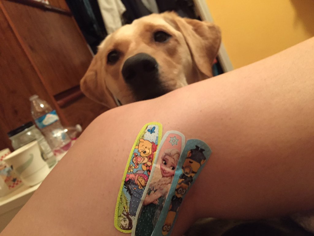 vijaa_sharp's tweet photo. Well. I've had two fat lips &amp; this huge cut on my leg this week. Can u guess who the culprit was??? 😑🙄🐶 https://t.co/MXWMRwXDZl