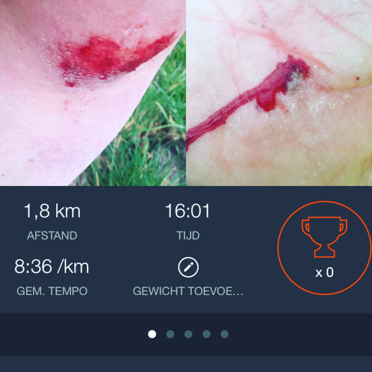 Daisycampforts's tweet photo. No sundayrun for me! #gevallen #auch #running  #notraining #bloed  misschien gisteren dan toch teveel wijn gedronken https://t.co/z2cFZLiqB4