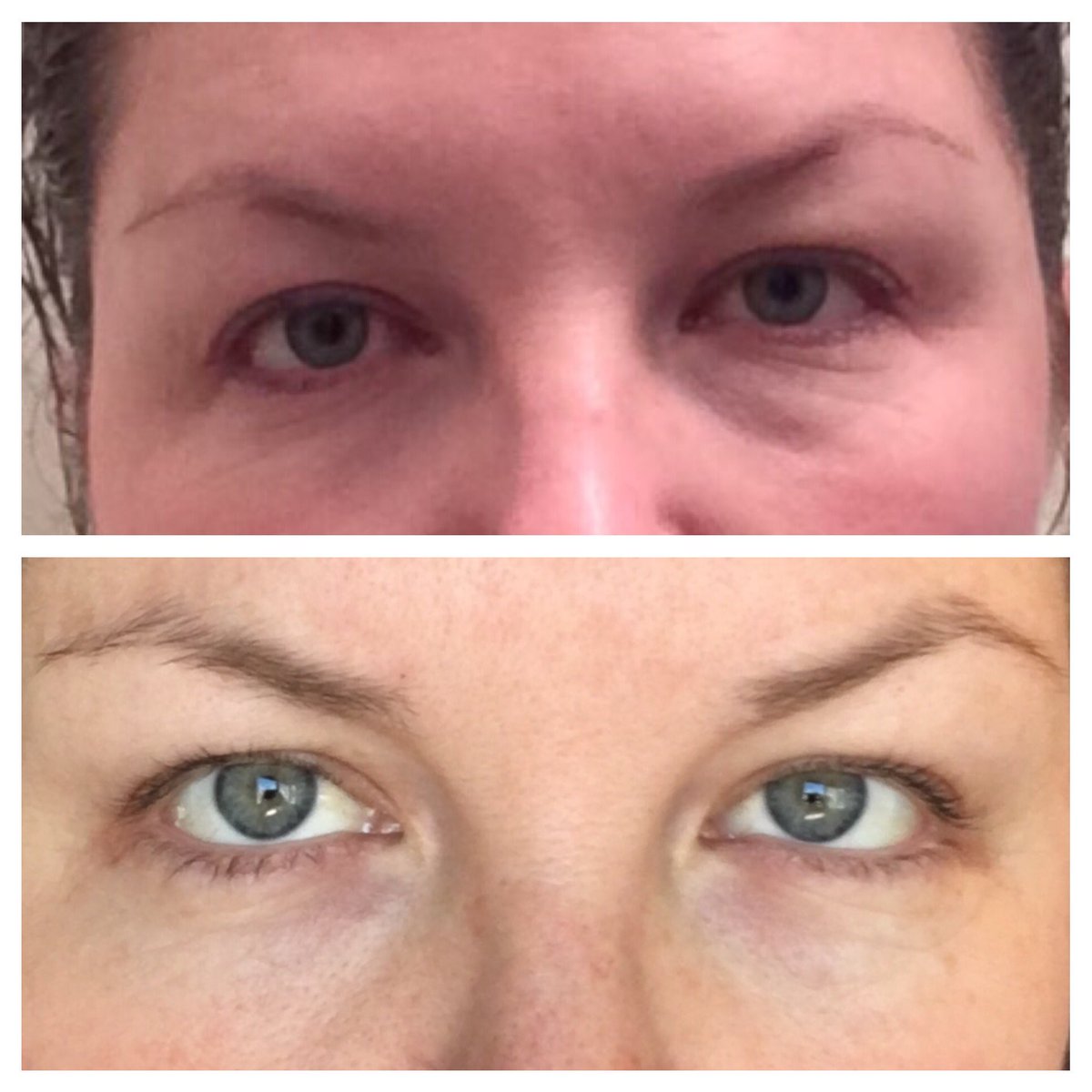 itworks4molly's tweet photo. Results after only 1 pack of It Works Facials!! Are you kidding me?? Ten years OFF my face! #itworks #itworksfacial https://t.co/LW8fgTgGoI
