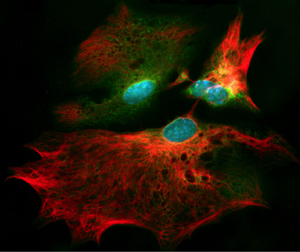 McArtofResearch's tweet photo. living astrocytes from the brain #MacArtofResearch https://t.co/FuGBvaloOZ