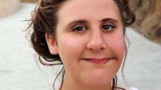 JRJPartridge's tweet photo. RT @FaceEquality: 17-year-old girl talks about growing up with #facialpalsy https://t.co/wEM1gsJL17 https://t.co/mXnMHKcTmT
