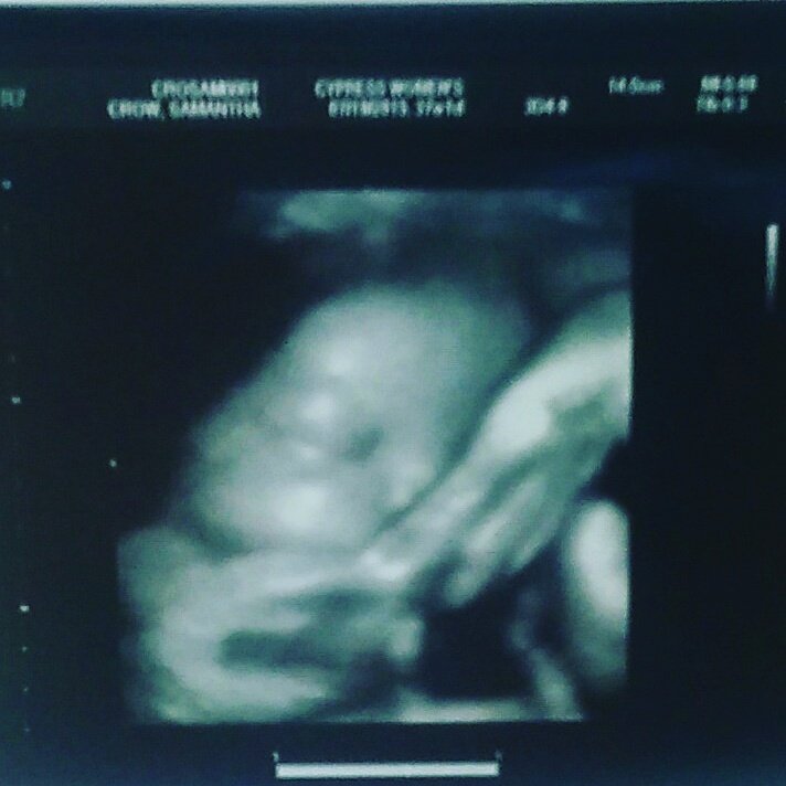 SamyJo6542's tweet photo. #ultrasound #sonogram #babyboy #8lbs #37weeks #doctor #mybaby #baby #almost #aprilbirth https://t.co/5359tqkFHC