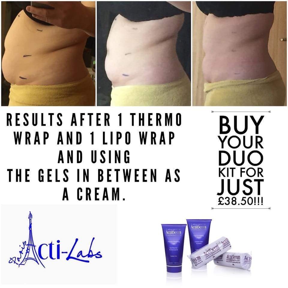 vickyfactiderm's tweet photo. #inchlosswraps #actilab #amazingresults #health #cleanse #skincare

Message me for more info or how to order! https://t.co/QVaEasPycO