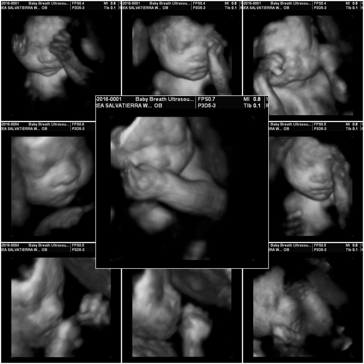 3d Baby Ultrasound breath1 Twitter 3d Baby Ultrasound breath1 Twitter