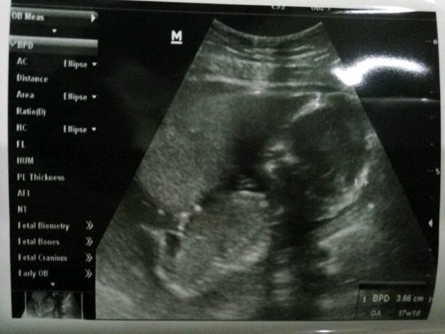 Baby cimut bala-bala sehat telus yaaa :* maap sayaang km jd ga ceria gegara momo masuk angin :( love u dearest :*