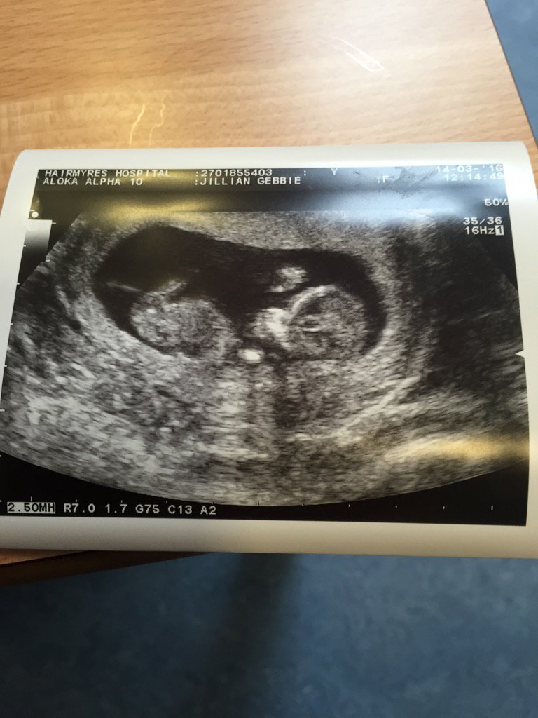 SandyGebbie's tweet image. Must be aff ma nut #babyno2