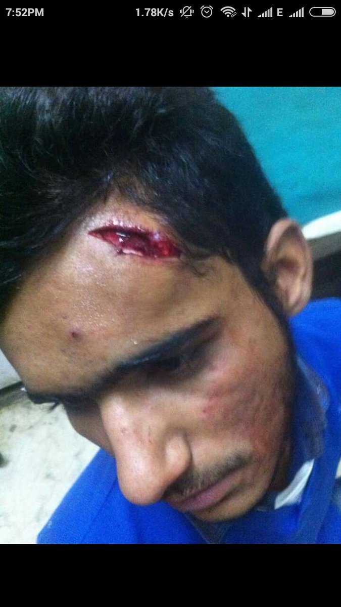 TheIntlHerald's tweet photo. India : Tear Gas and Lathi Charge on Non Kashmiri students at NIT Srinagar https://t.co/kftqJqlBzI