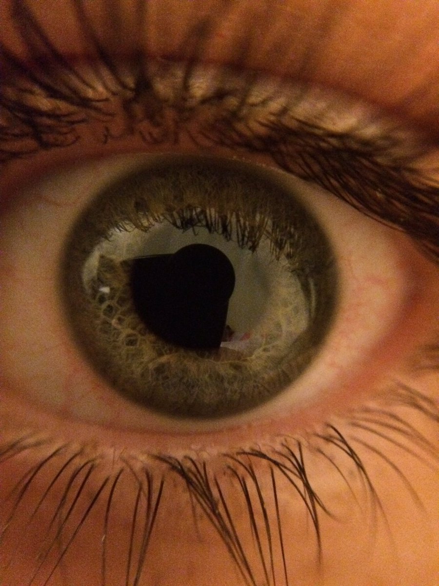 LordTobyGray's tweet photo. I got a macro lens for my iPhone @Kaylee_Nix #DatEye https://t.co/wuwpX7lxIg