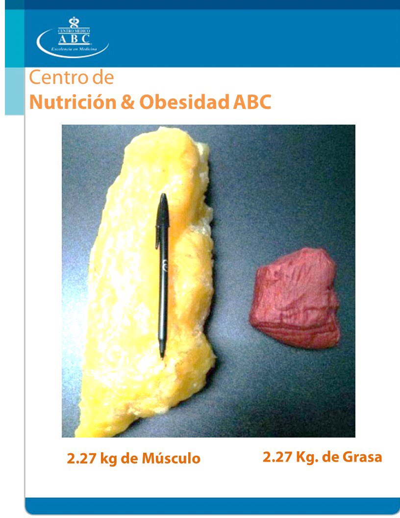 MaureenMostiM's tweet photo. Lo importante es de que son tus #kilos  poco #músculo. #sarcopenia https://t.co/xr88qf99Tl