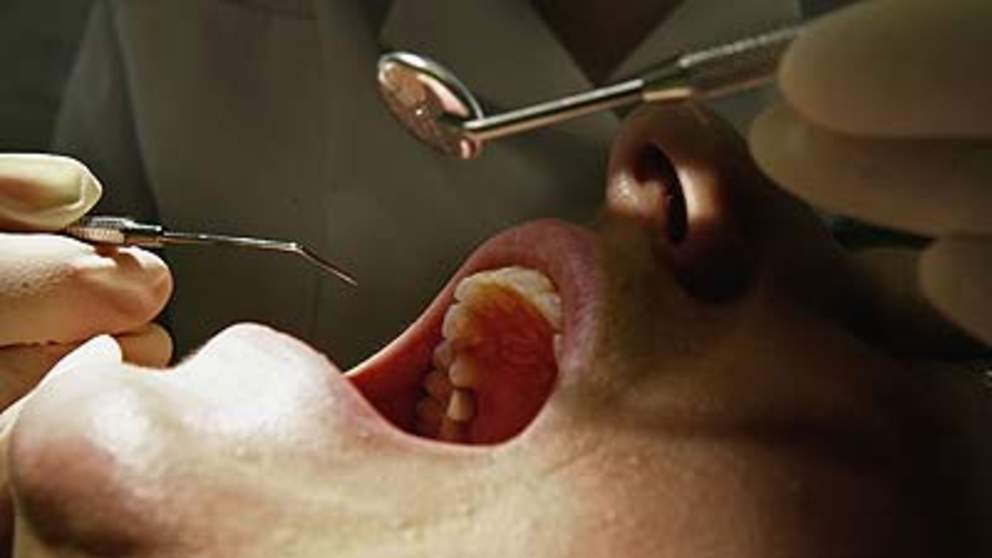 Victim of teeth whitening by a beautician told <a href="/SkyNews/">Sky News</a> its like being punched in the mouth bit.ly/1ZYUcEM